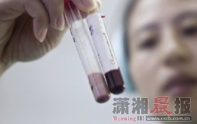 男子抽出乳白色血液 稱喜歡用油湯拌飯吃(圖)